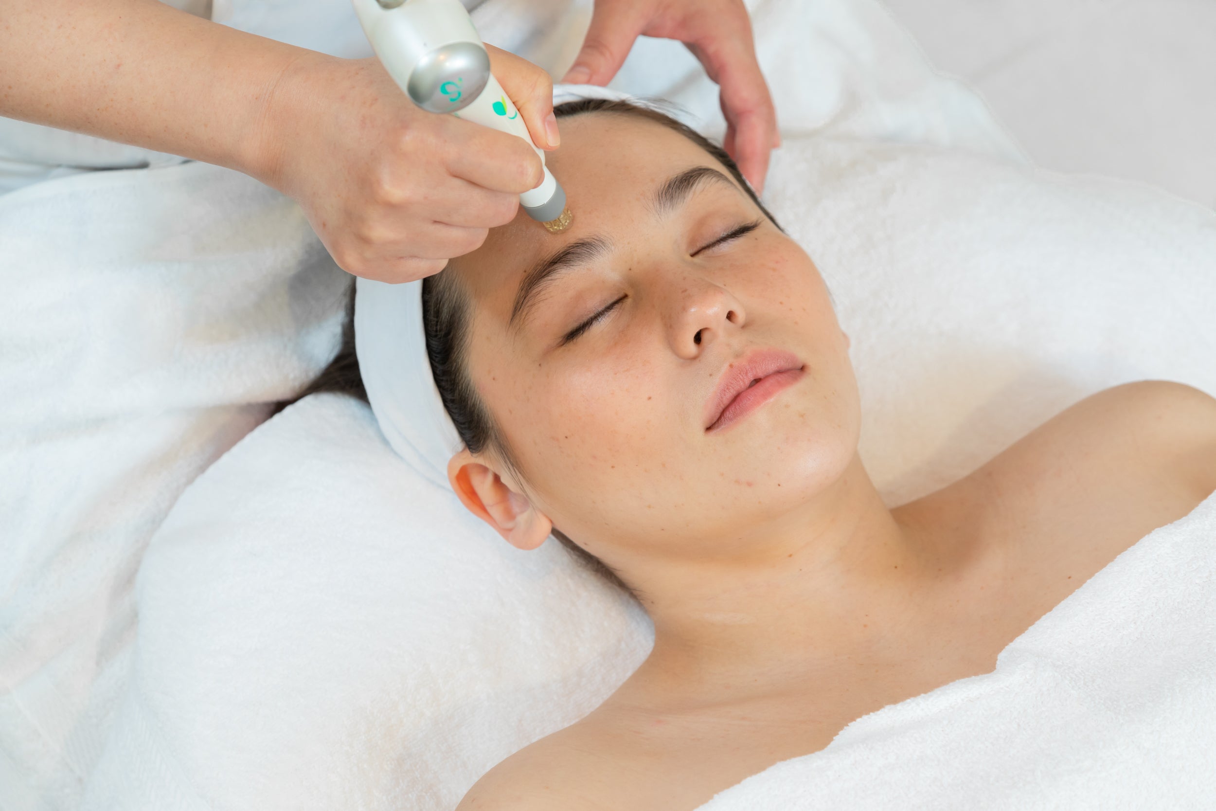 DermaPen Microneedling Treatment